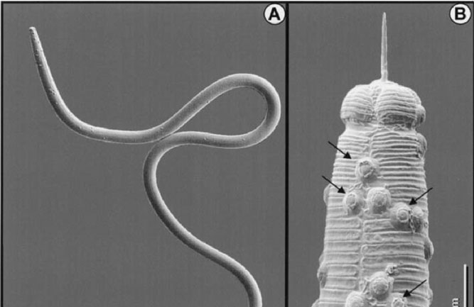 Photomicrographs of Pasteuria usage attached to sting nematode (Belonolaimus longicaudatus): A) male sting nematode with >30 spores, B) close-up of the spore-encumbered head region, C) close-up of attached spores, D) close-up of attached spore showing microfiber surface coating, and E) close-up of spent spore where the top of outer spore coat has become dislodged. (Photo: Journal of Nematology 33(4):227-238)