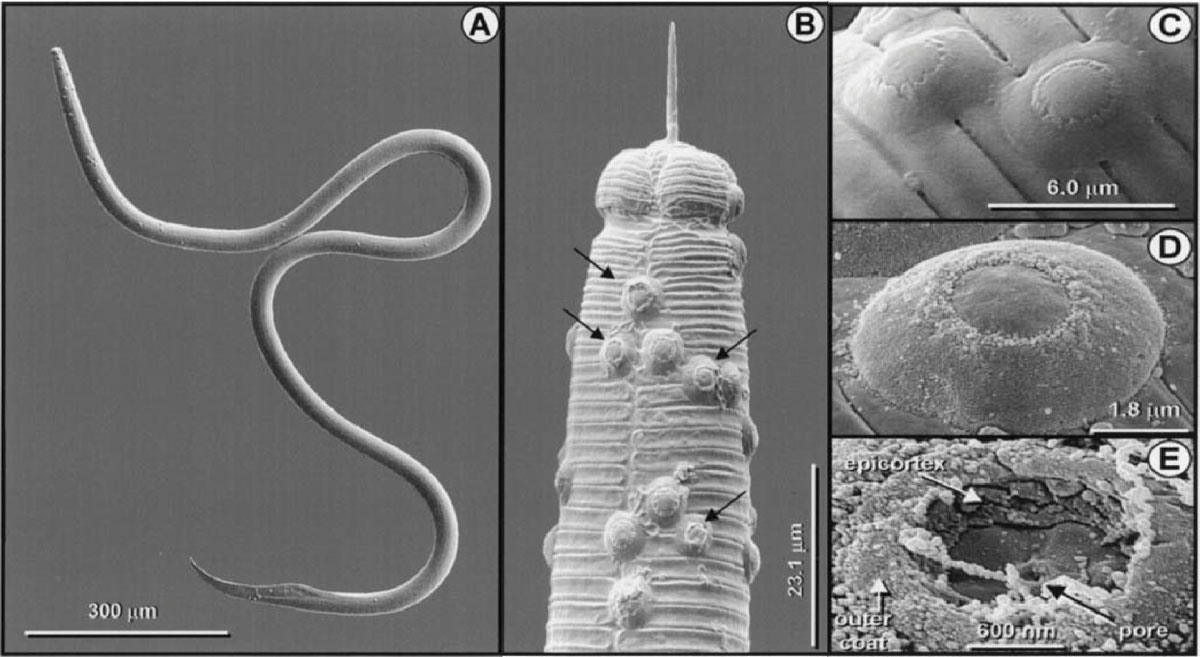 Photomicrographs of Pasteuria usage attached to sting nematode (Belonolaimus longicaudatus): A) male sting nematode with >30 spores, B) close-up of the spore-encumbered head region, C) close-up of attached spores, D) close-up of attached spore showing microfiber surface coating, and E) close-up of spent spore where the top of outer spore coat has become dislodged. (Photo: Journal of Nematology 33(4):227-238)