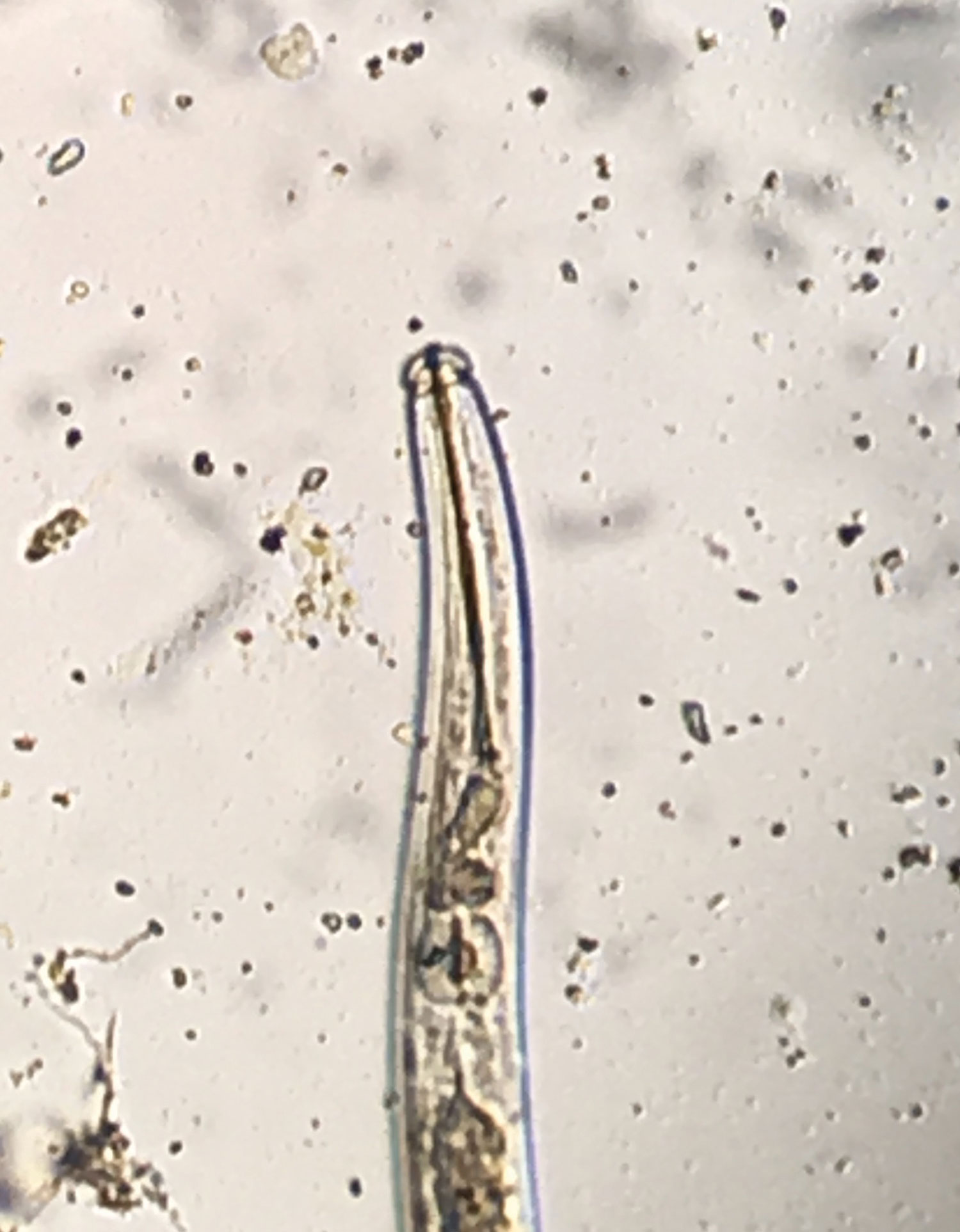 Photo:Sting nematode has a long stylet that allows it to feed deep within root tissues. (Photo: Bruce Martin)